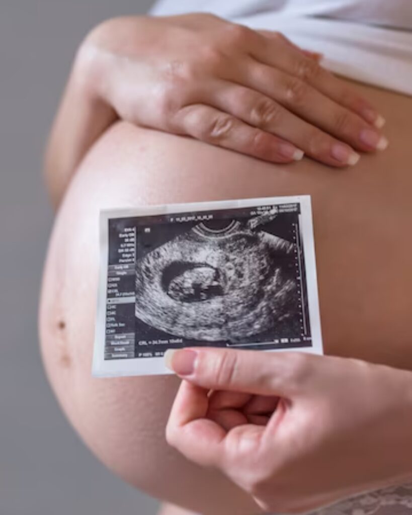 aumentar posibilidades de embarazo con acupuntura